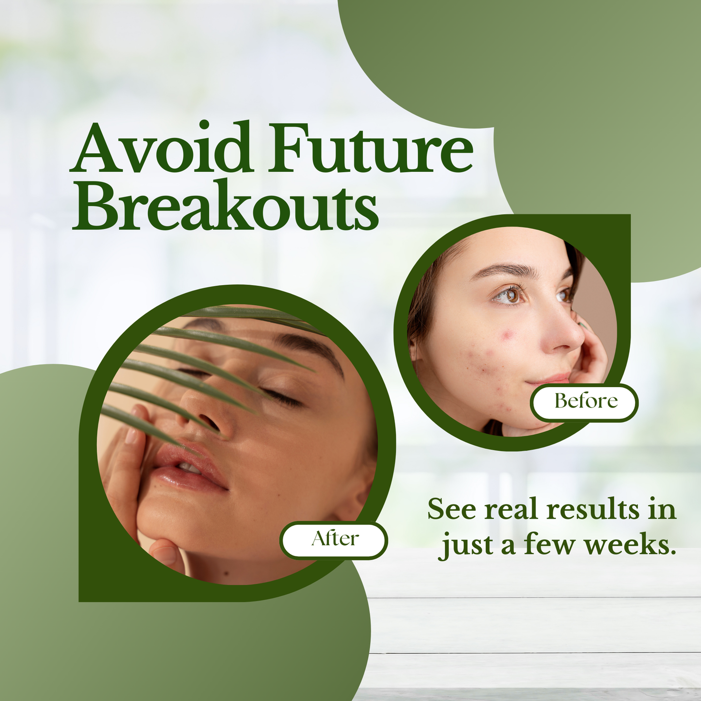 Acne Control Bundle