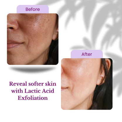 Exfoliating Serum - Lactic Acid